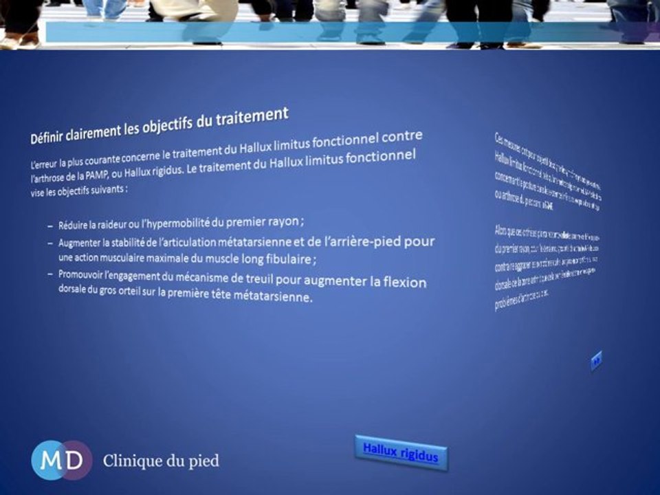 L’utilisation d’orthèses plantaires pour les douleurs du pied causées par un Hallux rigidus