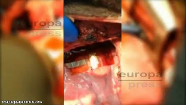 El corazón, fuente inagotable de energía renovable