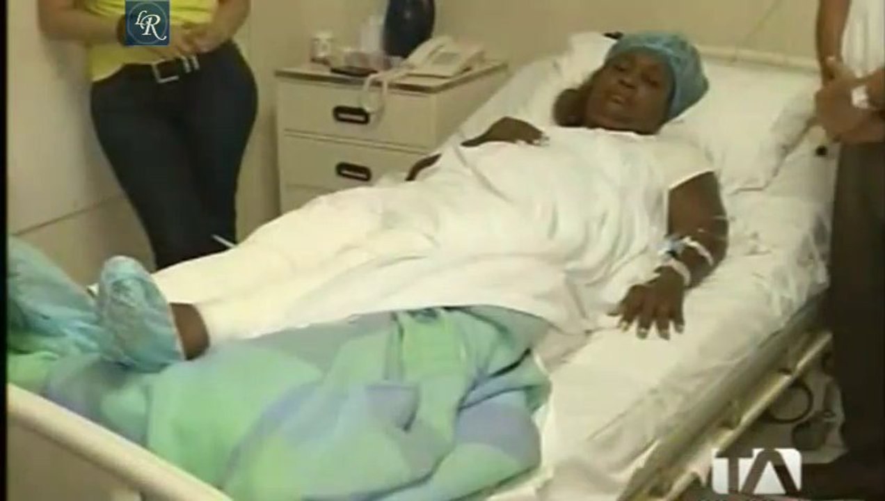 Mayra Montaño La Bombom sufrió quemaduras en sus piernas, Guayas Ecuador