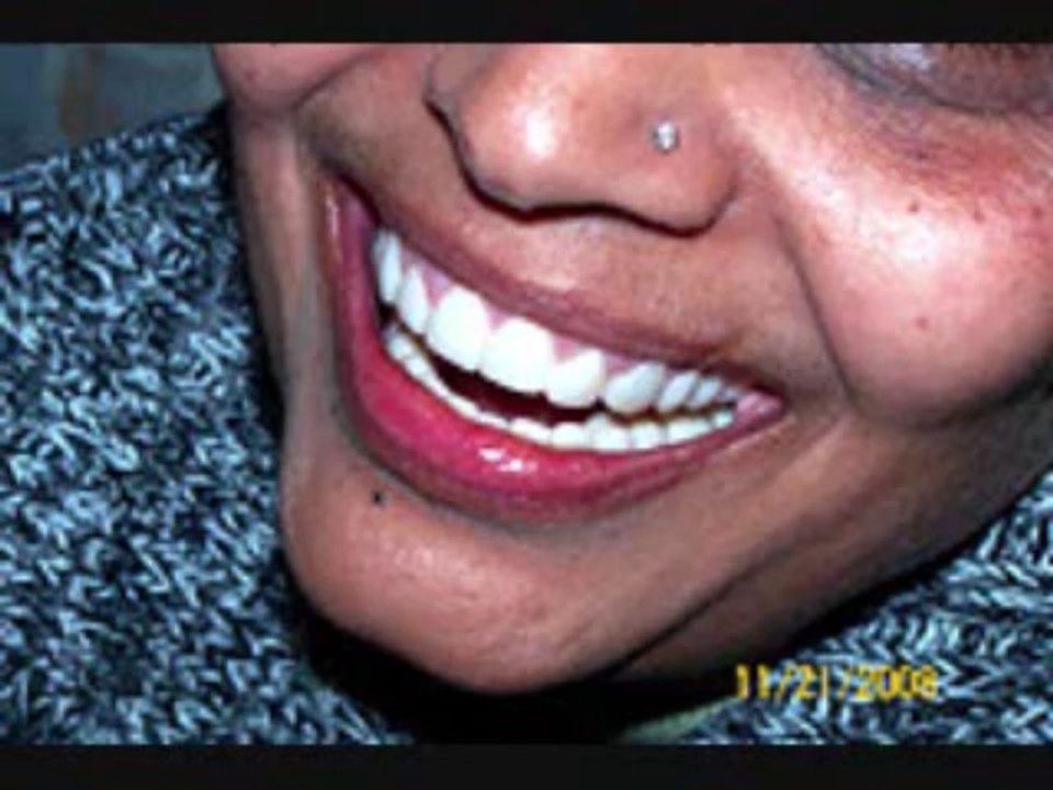 Dentist lady lake