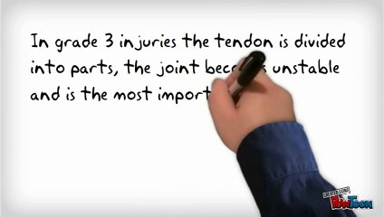 Carpal Tunnel Surgery Recovery Time