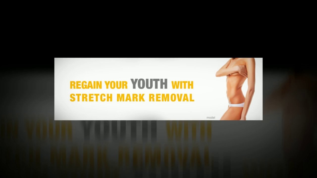 Beverly Hills Laser Stretch Mark Removal