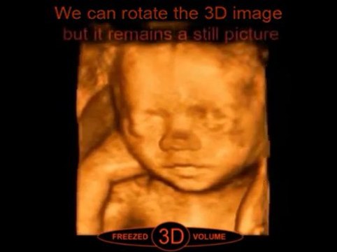 Book 3D-4D Ultrasound Scan Service Online - My First Foto