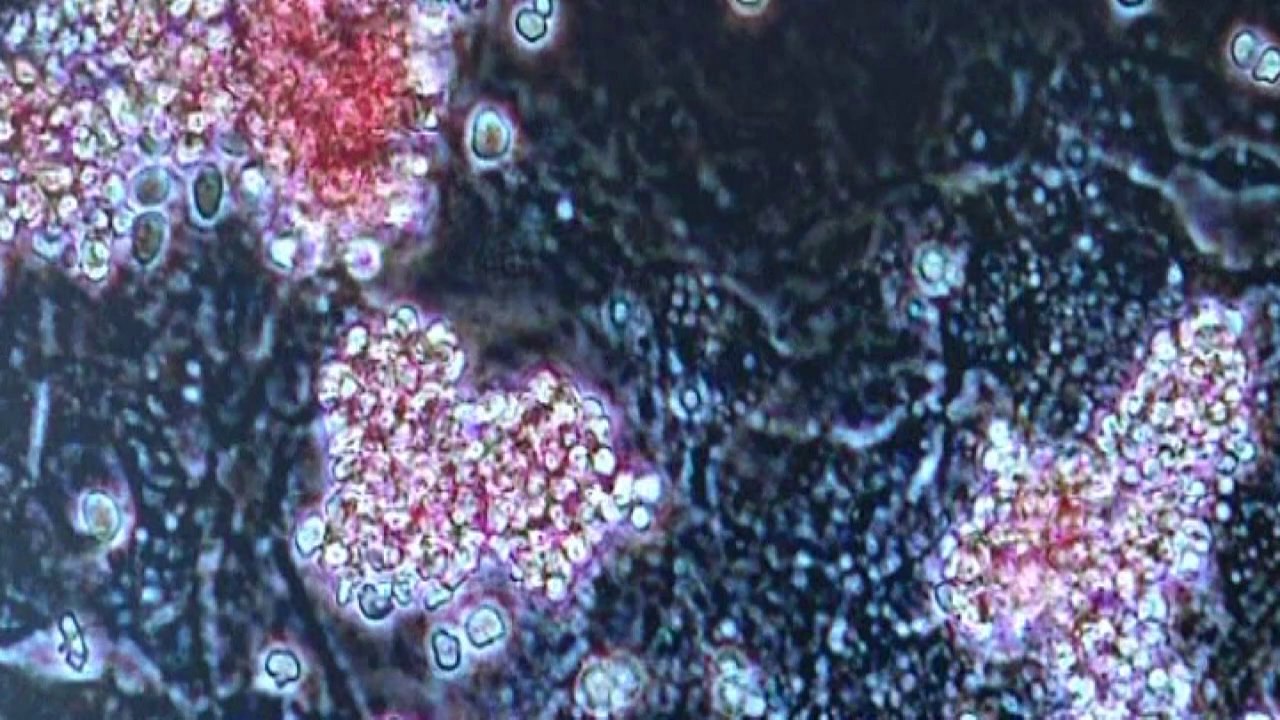 Doctor hails stem cell breakthrough as "game changer"