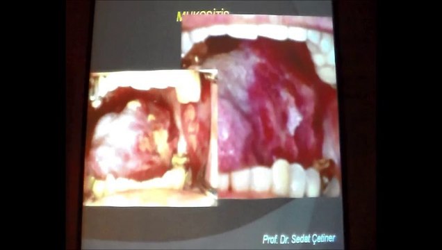 PROF.DR.DENİZ YAMAÇ & PROF.DR.SEDAT ÇETİNER 23 OCAK 2014 ADO EĞİTİM SEMİNERİ 2