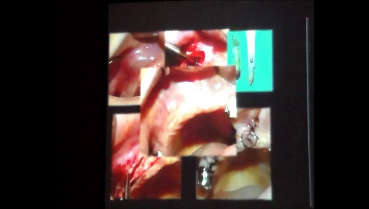 PROF.DR.CELAL BAHADIR GİRAY 30 OCAK 2014 ADO EĞİTİM SEMİNERİ