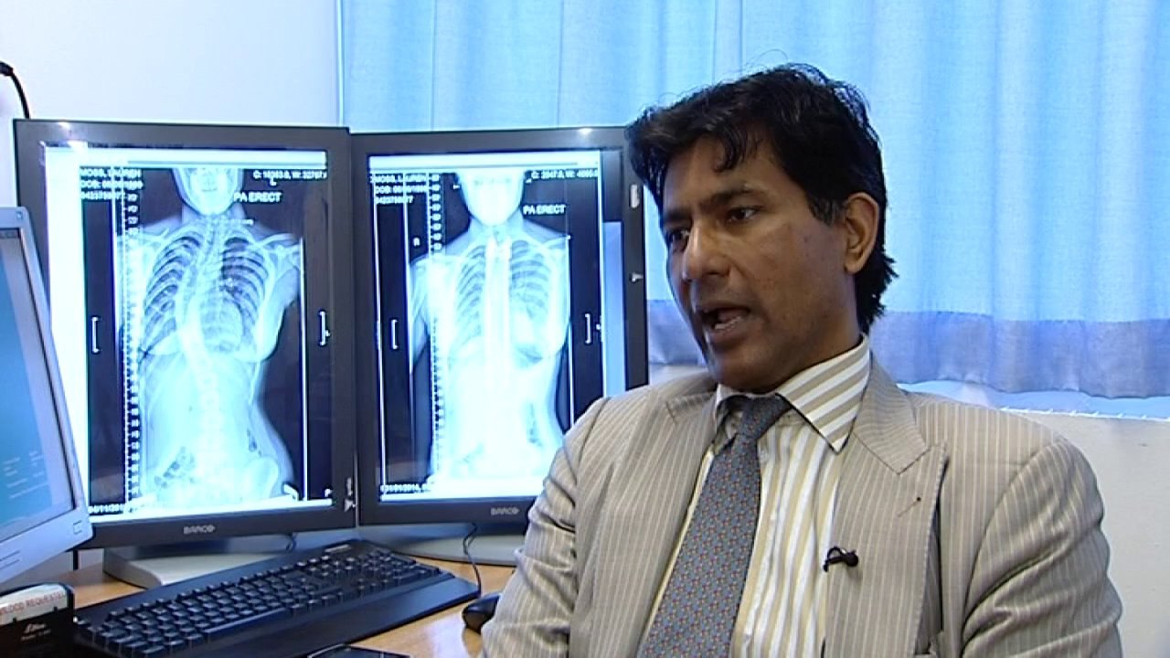 New technology brings hope to children with curved spines