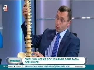 Skolyoz - Omurga Eğriliği bölüm 1