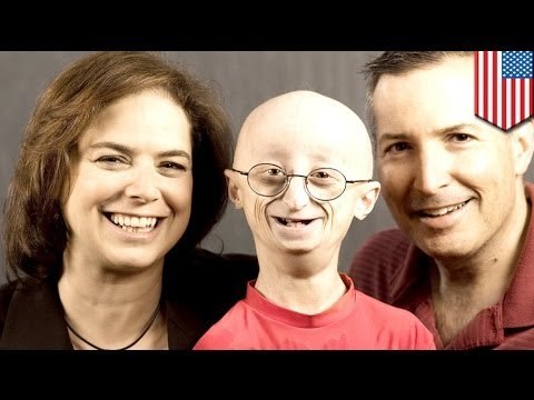 17-year-old dies from extremely rare aging disease