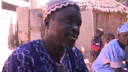 الجذام مرض استوائي مهمل يستمر في التشويه والنبذ