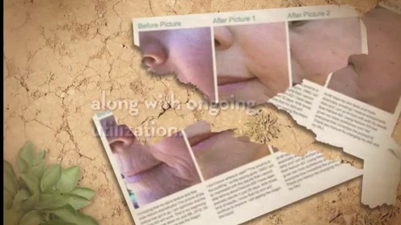 Nerium Ad