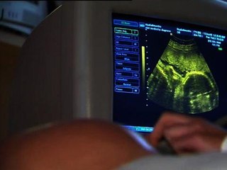 PMA - GPA: une promesse non tenue au parcours sinueux - 03/02