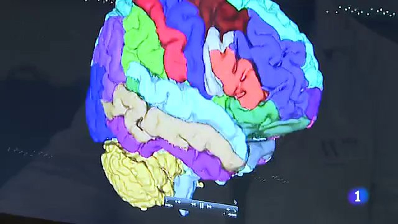 Cerebro bilingüe
