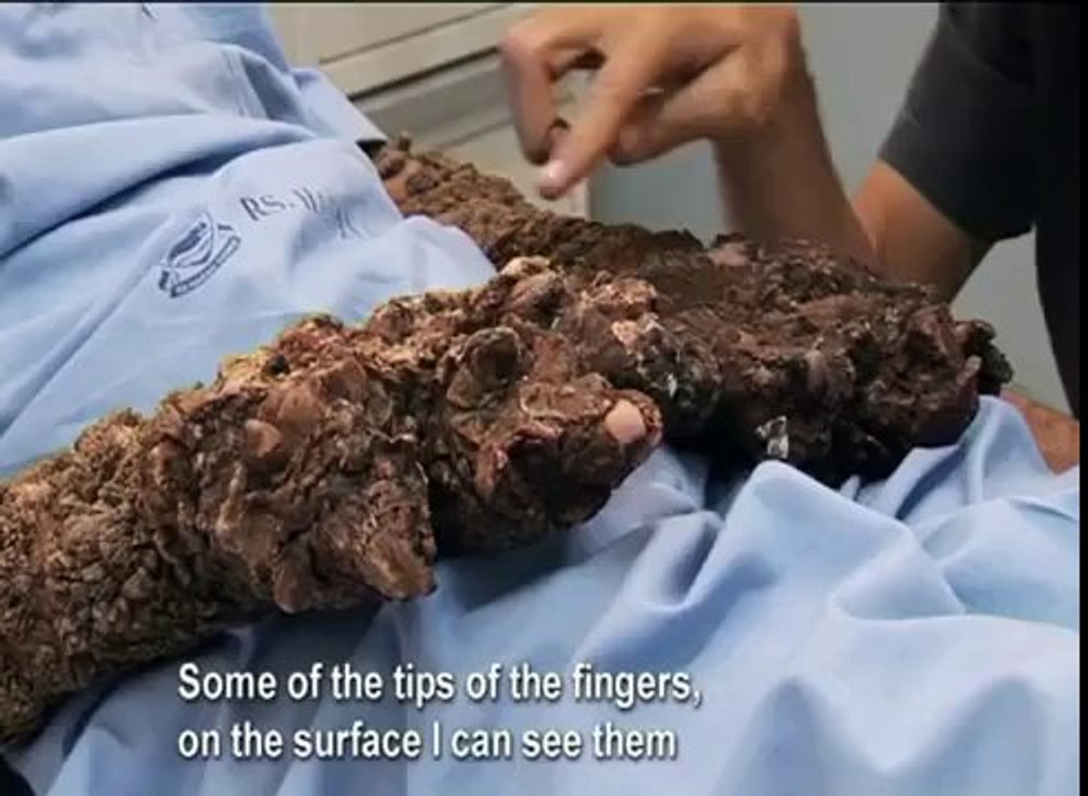 Man growing as Tree -  Watch and share