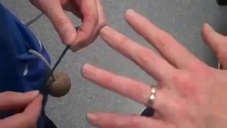 How to remove a ring from a swollen finger| www.itblow.com