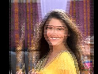 Has Anushka done another lip job?