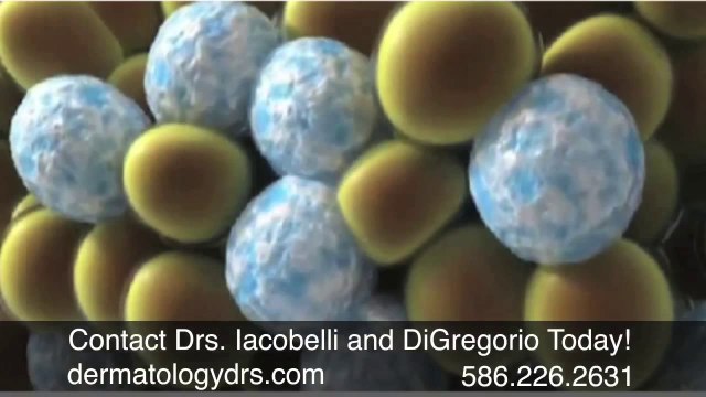 Coolsculpting Detroit, Dermatology Drs.