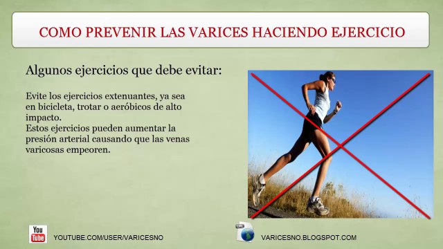 COMO PREVENIR LAS VARICES HACIENDO SENCILLOS EJERCICIOS -V 1