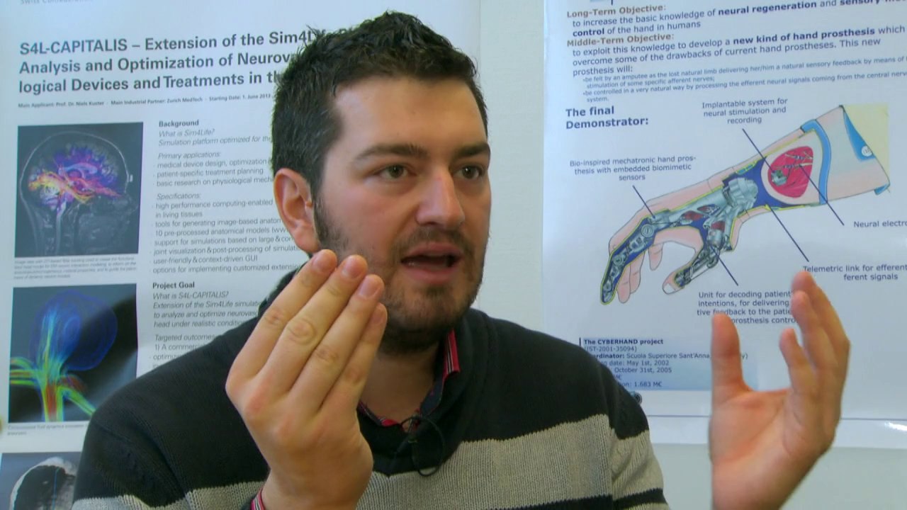 'Bionic hand' can now sense shape, texture