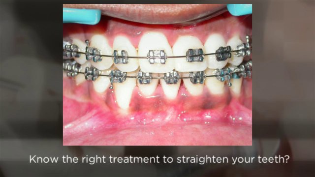 Sonoma Smiles Emergency Dentist- Santa Rosa, CA