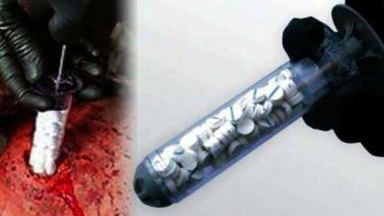 New Sponge-Filled Syringe Seals Up Bullet Wounds in 15 Seconds