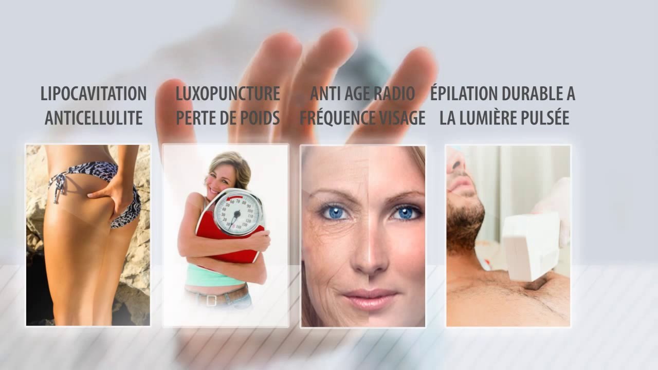 Epilation définitive Selestat