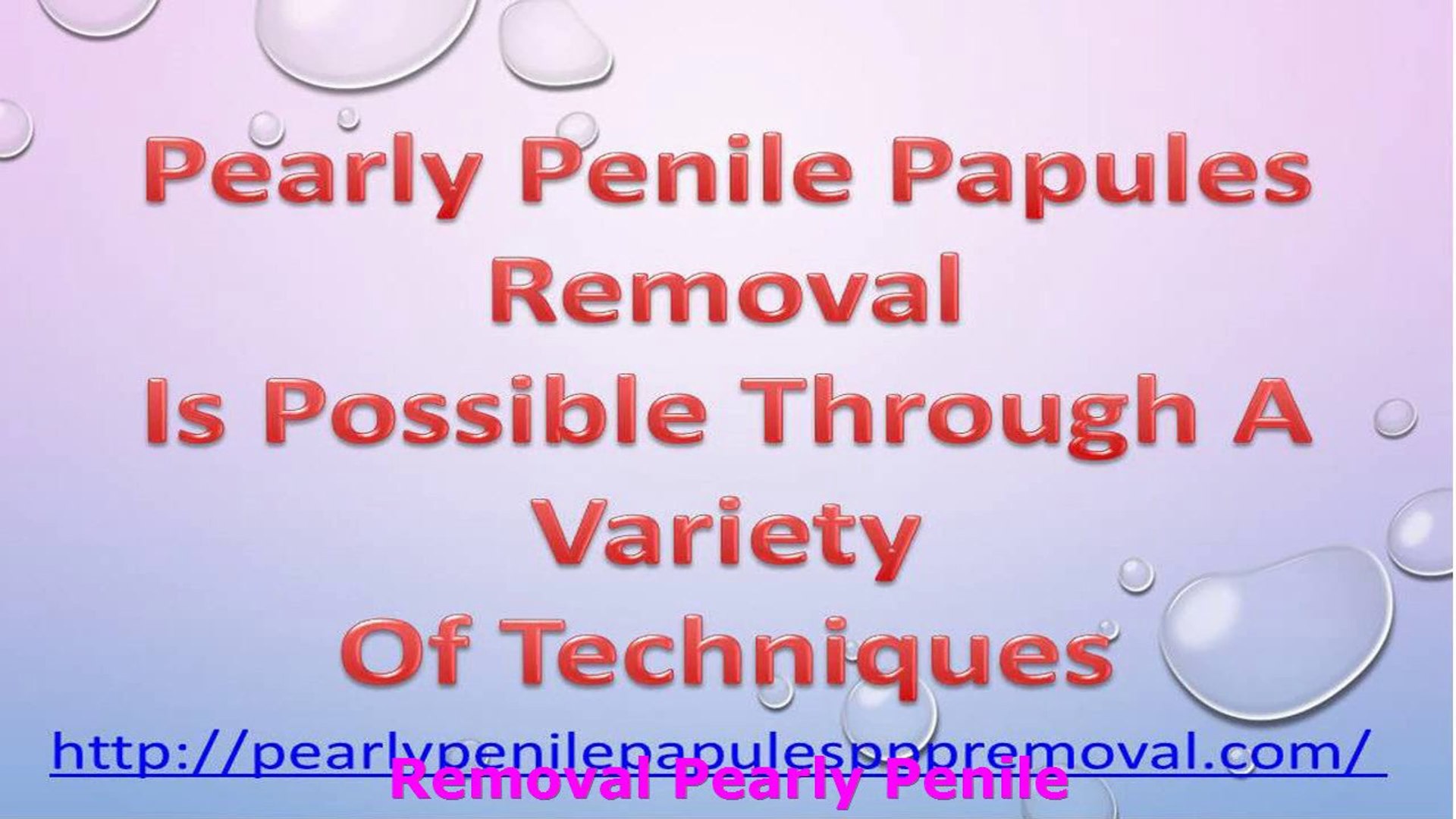 Papules pearly wiki penile PPP Removal