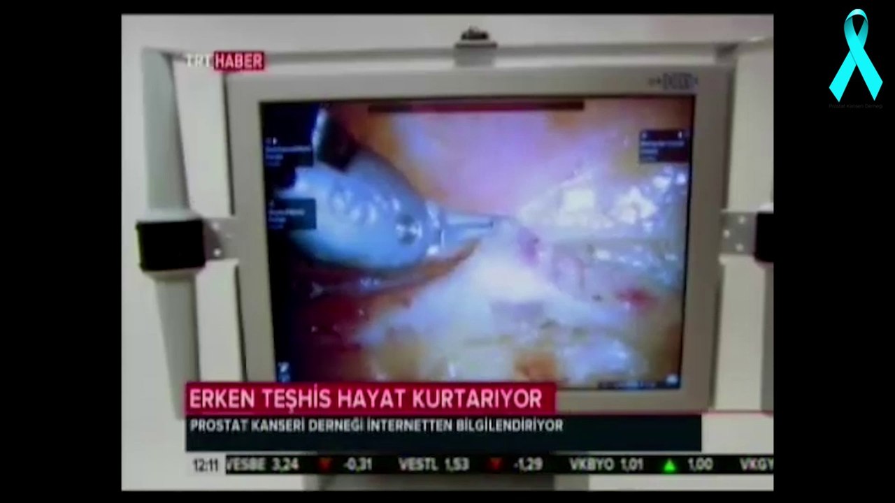 Erken Teşhis Hayat Kurtarıyor - TRT Haber Anahaber