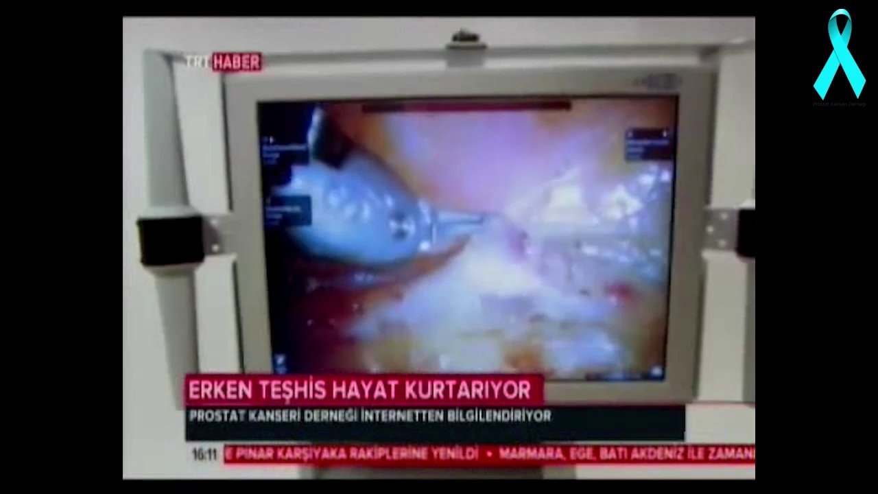 Erken Teşhis Hayat Kurtarıyor TRT Haber Türkiye Ajansı