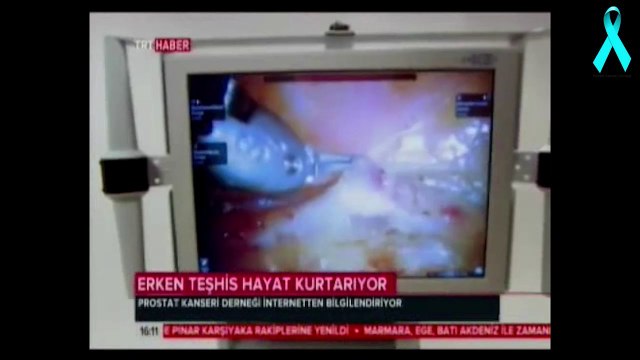 Erken Teşhis Hayat Kurtarıyor TRT Haber Türkiye Ajansı