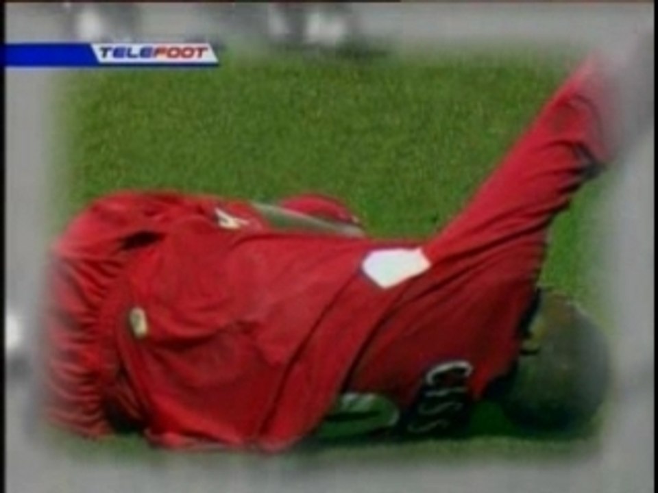 Djibril.Cisse.-.Double.fracture