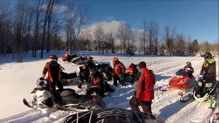 Snowmobile Crash - BROKEN Tib And Fib