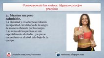 Prevenir las varices-Algunos consejos practicos