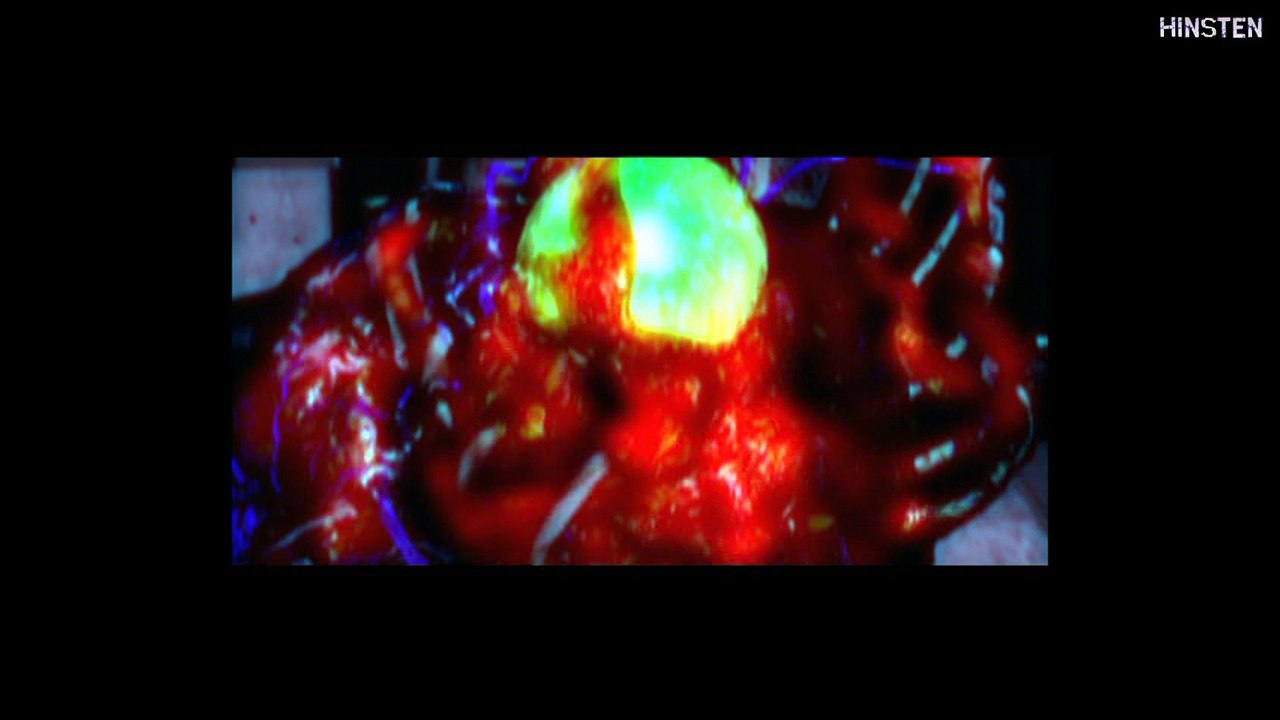 Extermination Playthrough Part 2 [PCSX2]