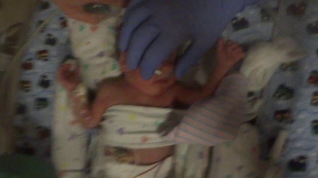 Feeding Tube Goodbye!