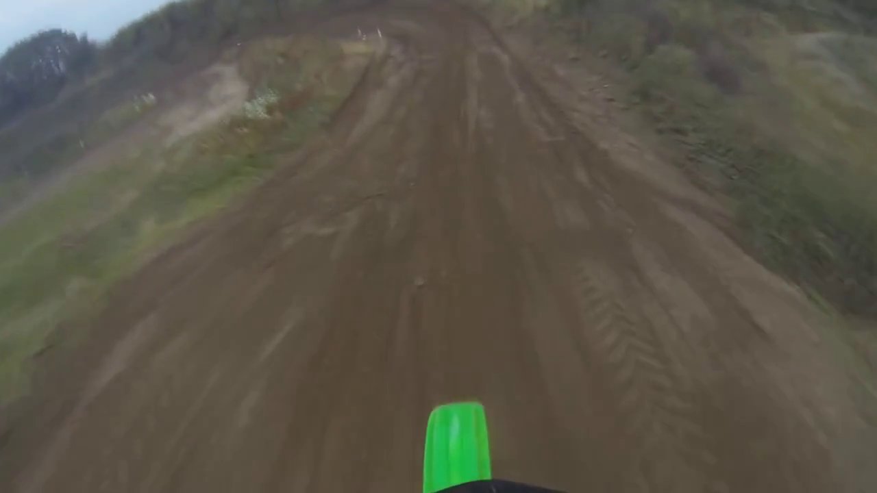 Crazy Dirt Bike CRASH  - Broken Leg!