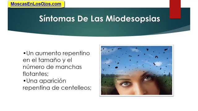 Principales Causas De Las Miodesopsias: Las Miodesopsias y Cuales Son Sus Principales Causas