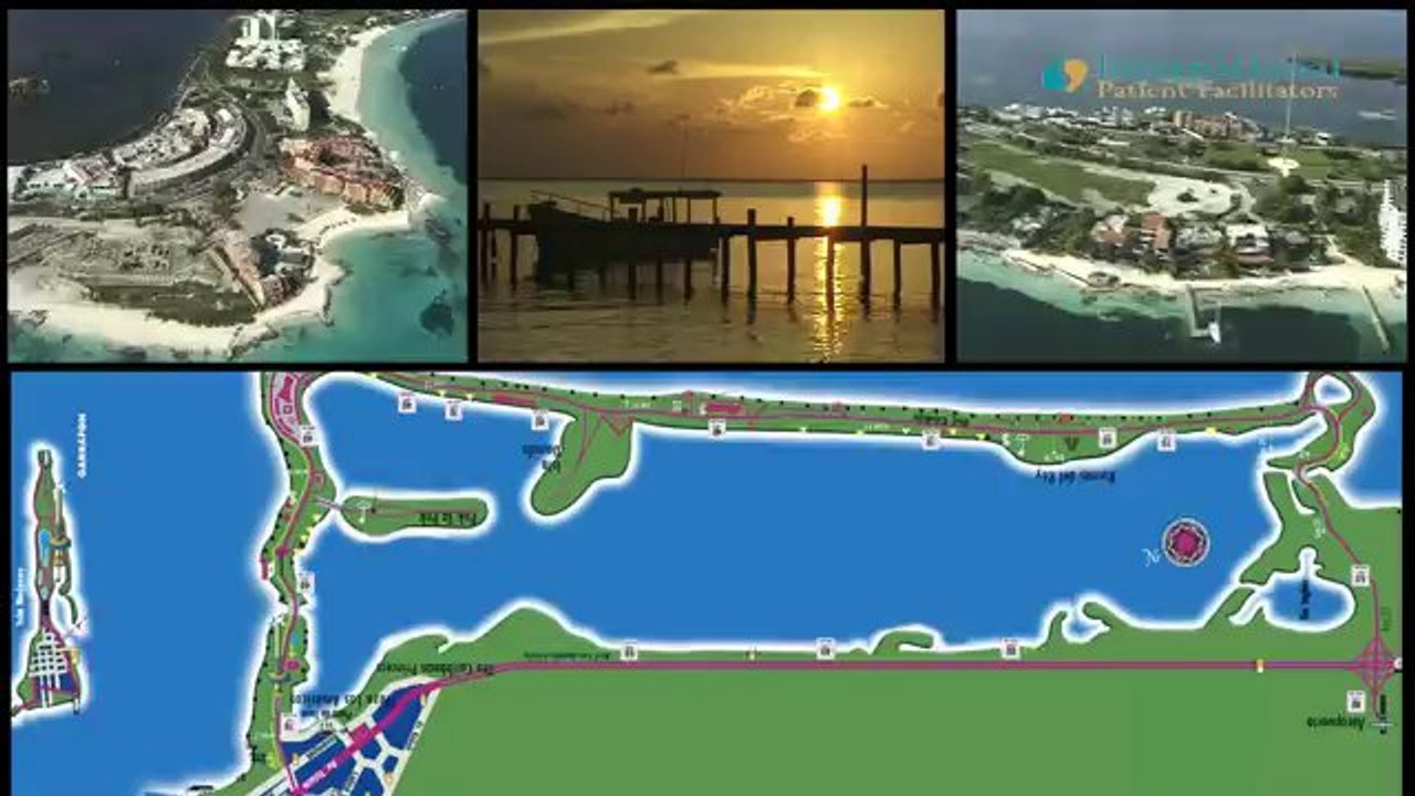 Weight Loss Surgery Tijuana Mexico by Sheri Burke