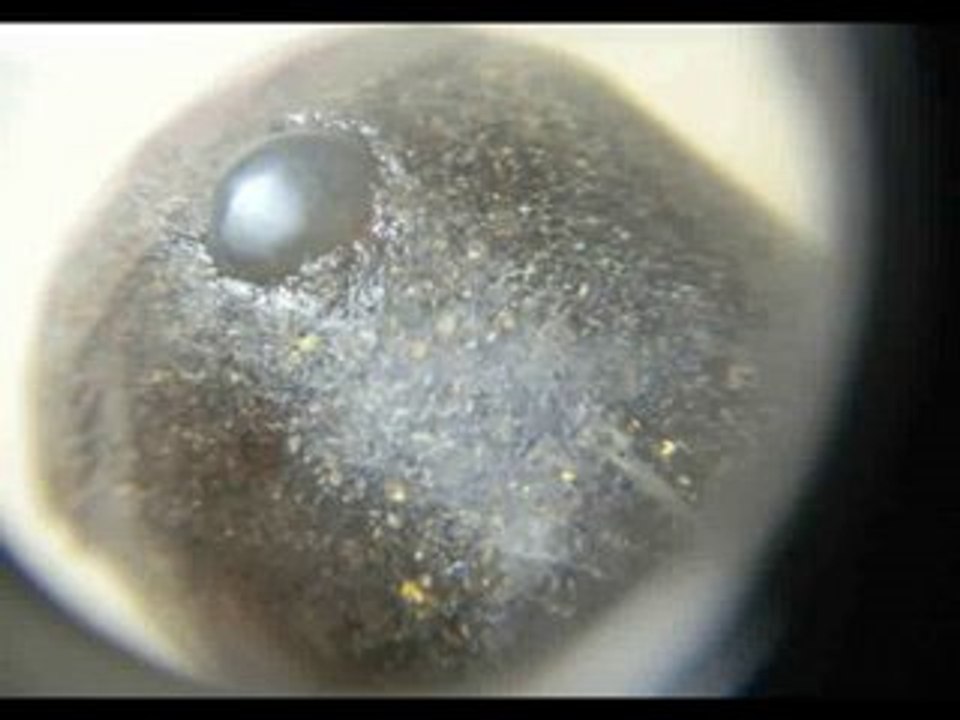 mystery stone type two