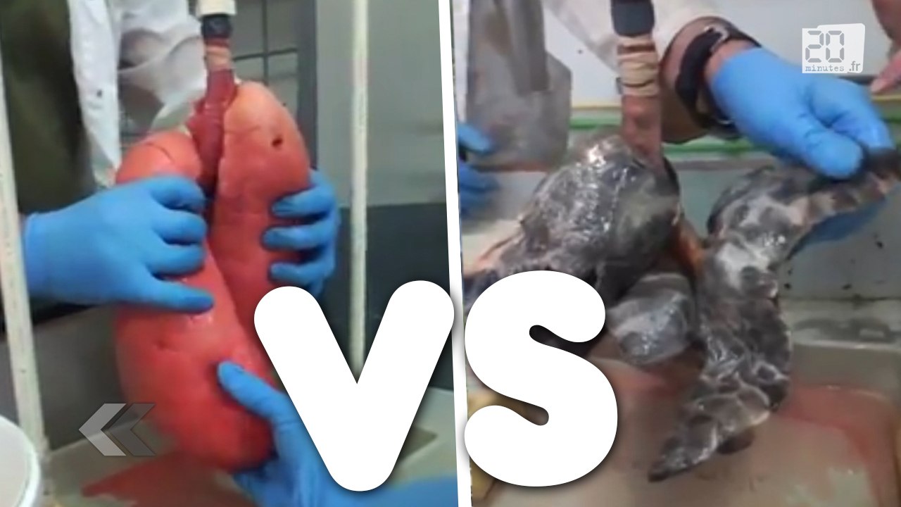 Fumeur vs non fumeur