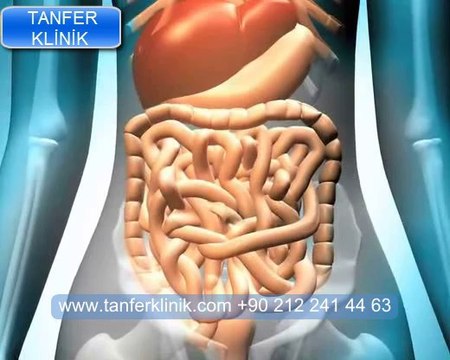 Tanfer Klinik - Ağız kokusu hangi hastalıkların belirtisi olabilir