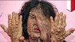 Bubble skin woman: Mother with shocking skin disease forced to flee Indonesian village
