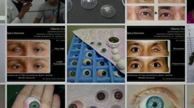 Protesis Oculares en Venezuela