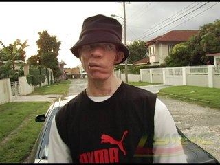 King Yellowman speaks about how he was abused growing up