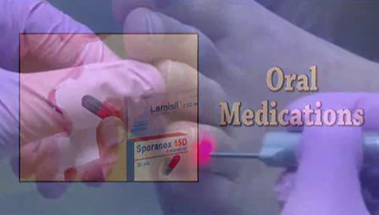 Laser Fungal Toenail Therapy - Podiatrist -  Houston, TX - Britt Larka, DPM