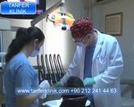 Tanfer Klinik-  Diş eti kanaması tedavi edilmezse ne olur