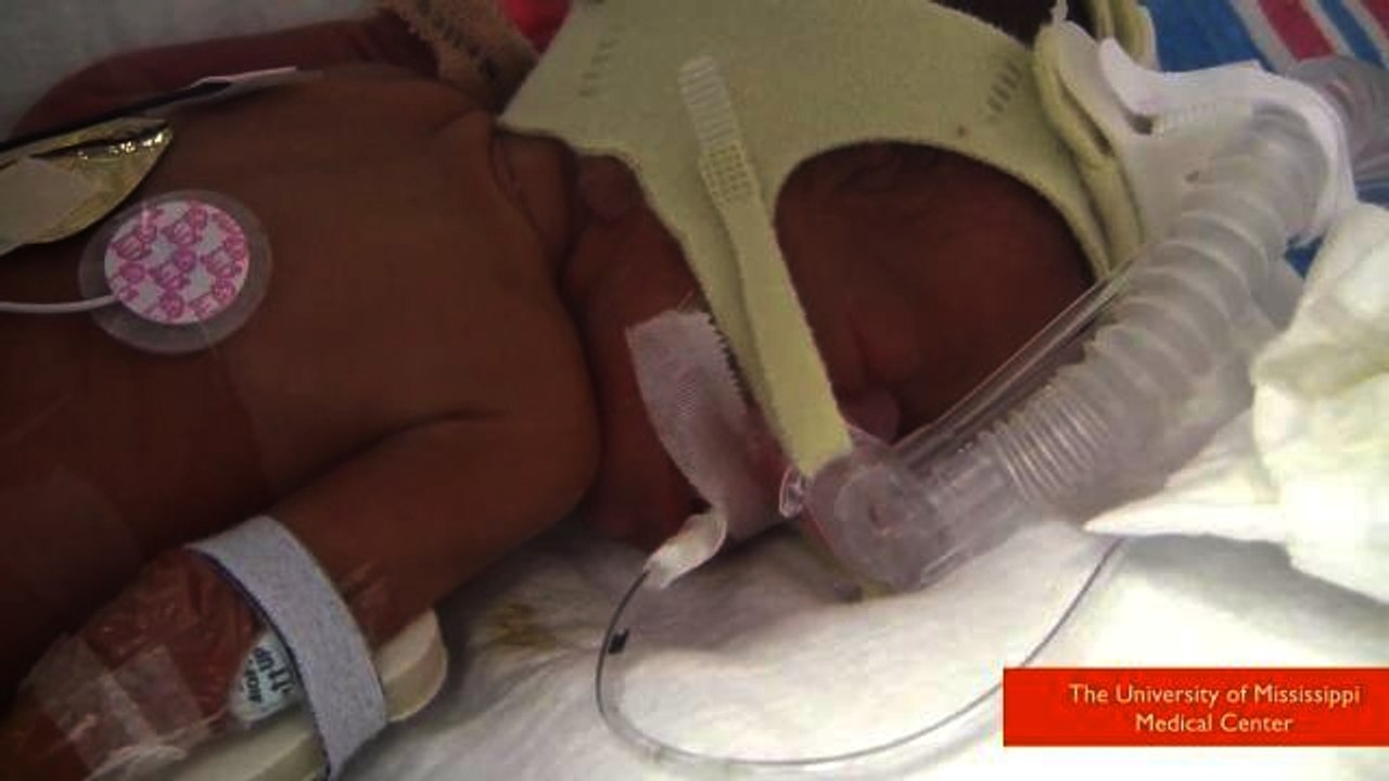 Mom Finds Out She's Having Identical Quadruplets in Delivery Room