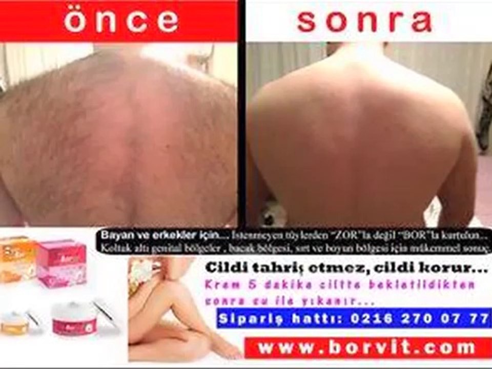 TÜY DÖKÜCÜ KREM KILLARDAN KURTULUN