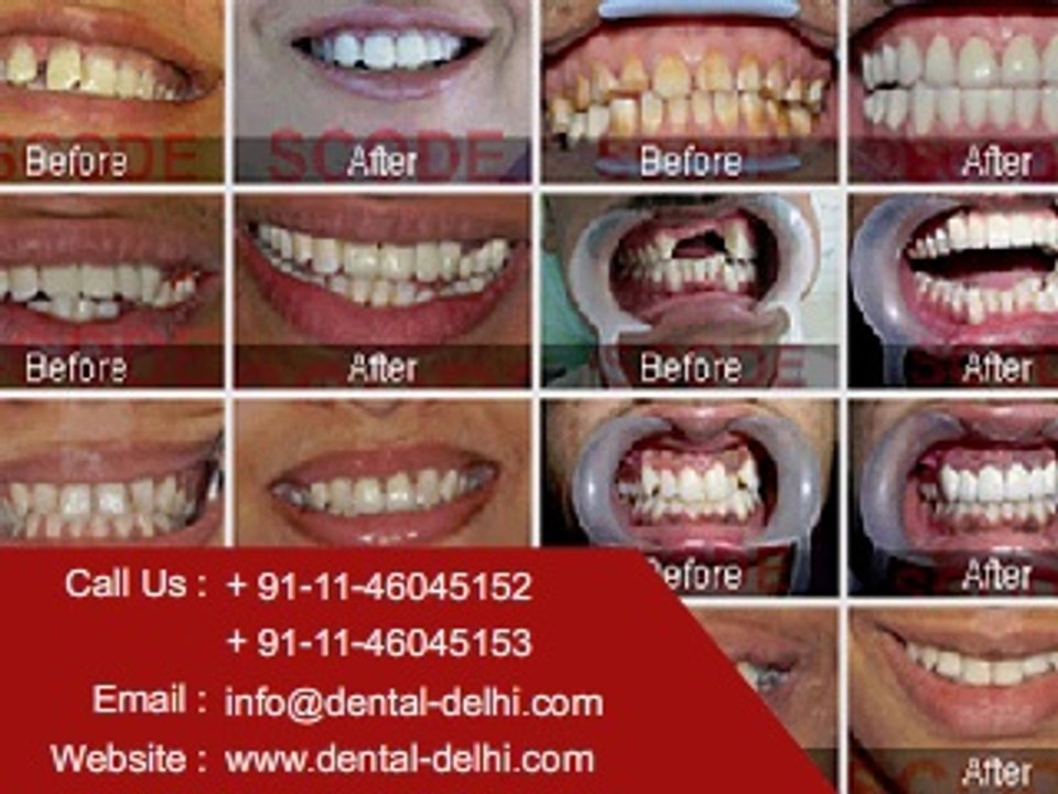 Cosmetic Dentist Clinic in New Delhi, Cosmetic Dentist South Delhi, Cosmetic dentistry clinic in Green park