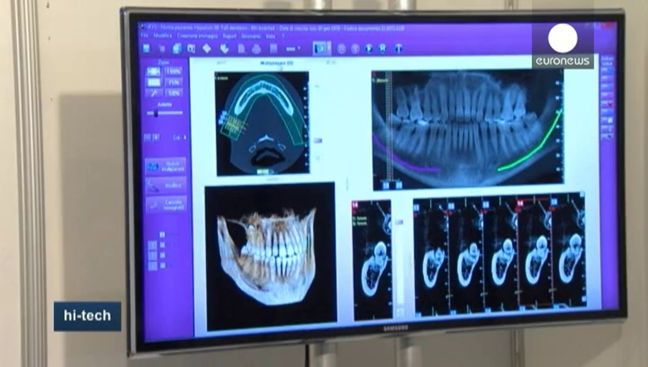Imagina, le hi-tech de l'odontologie